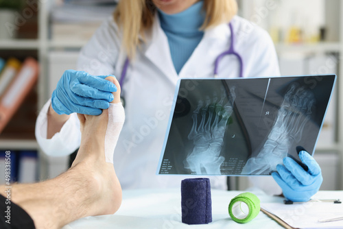 Canvas Print Patient with leg injury at doctor appointment closeup
