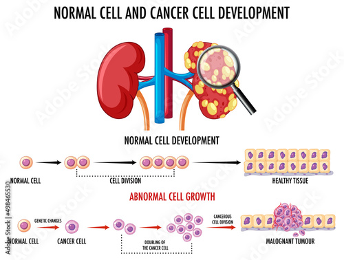 Diagram showing cancer development process