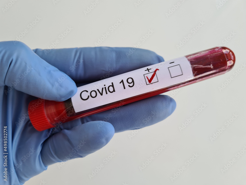 Obraz premium Doctor in glove holds test tube with positive covid-19 test