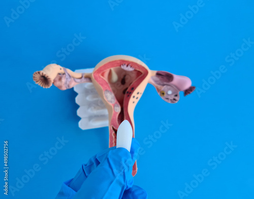 Foto Medical vaginal suppositories for uterus closeup