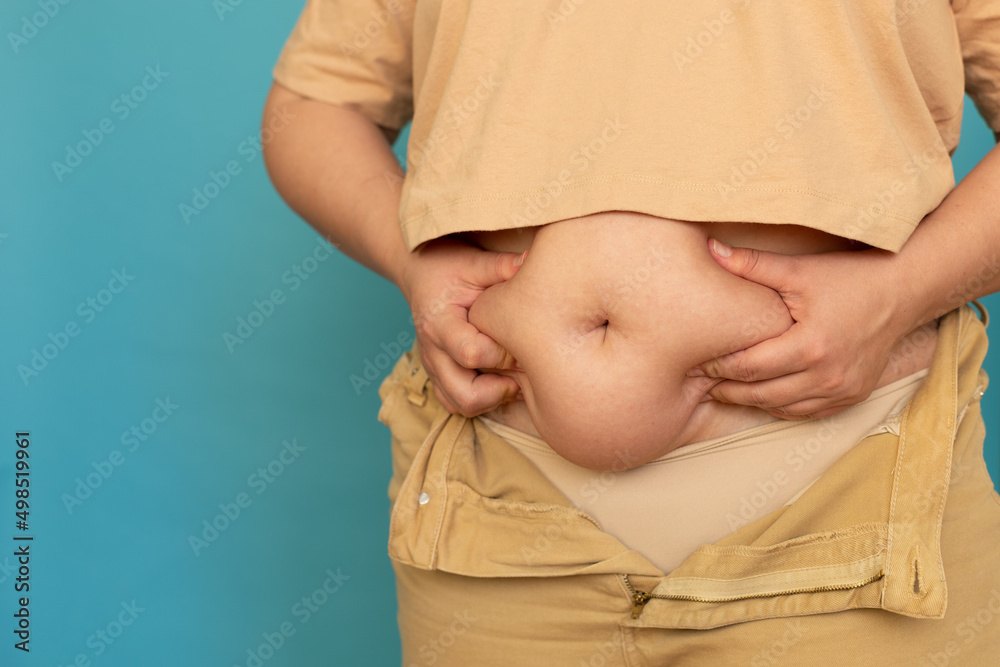 Cropped photo of plump plus-size overweight woman wearing beige T-shirt and  jeans, showing squeezing excess naked belly on blue background. Body  positive, cellulite, obesity, weight loss, liposuction. Stock Photo | Adobe  Stock