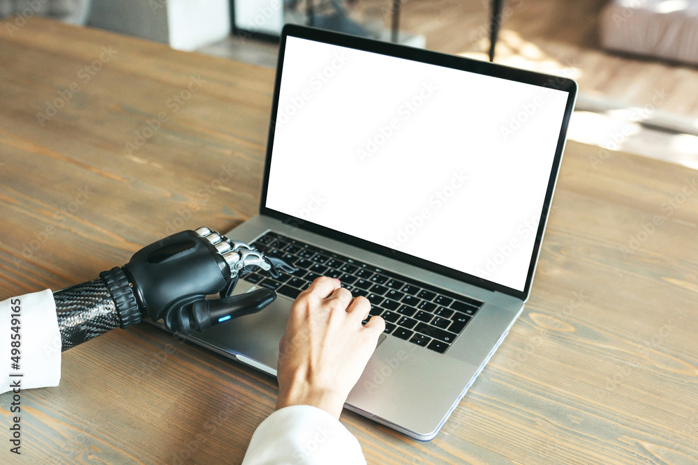 A close-up photo of a disabled woman with a bionic prosthesis is typing on a laptop while sitting at a table. Online work, distance learning. Mockup