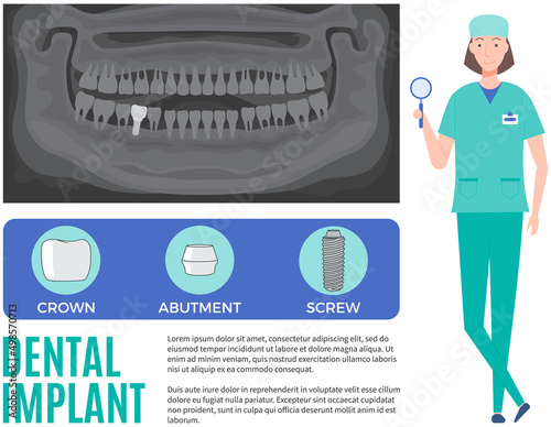 Female doctor talking about dental prosthesis structure. Implantation dentistry, stomatology. Tooth care, treatment. Dental implant creation scheme. Sequence of connection of screw, abutment and crown