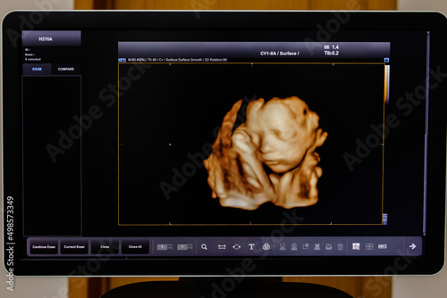 Picture 4D with Ultrasound of baby in mother's womb show the face. photo