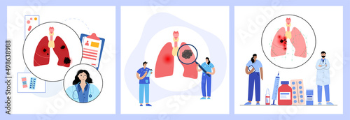 Thyroid cancer stages
