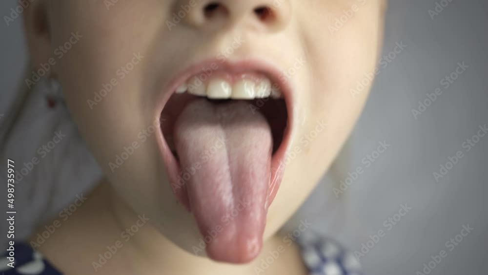 kid salivation girl opens her mouth child shows his teeth soft ...    