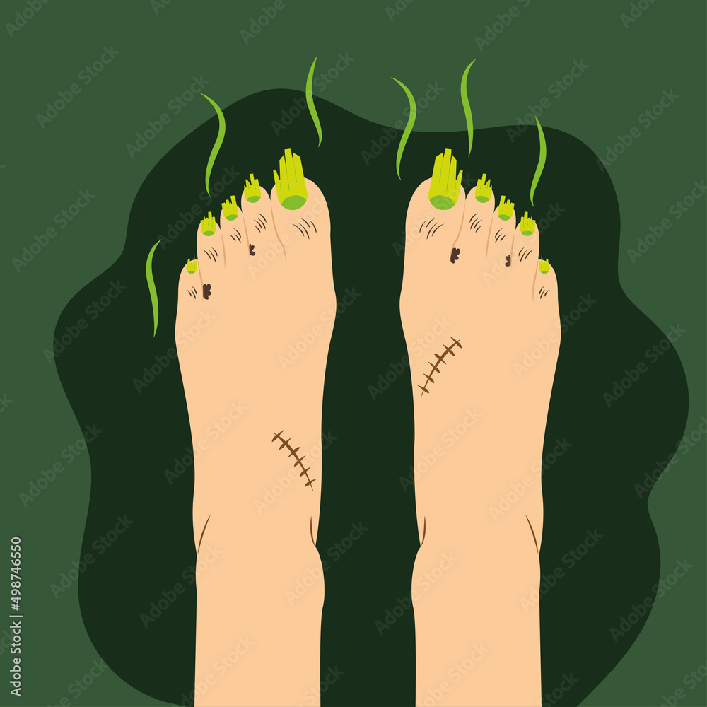 Vector illustration. Ugly feet. Smelly feet. Long toe nails. Dirty feet