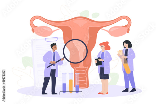 Tiny doctors examining uterus with magnifier. Endometriosis, vaginal disease or infertility treatment flat vector illustration. Health, medicine concept for banner, website design or landing web page