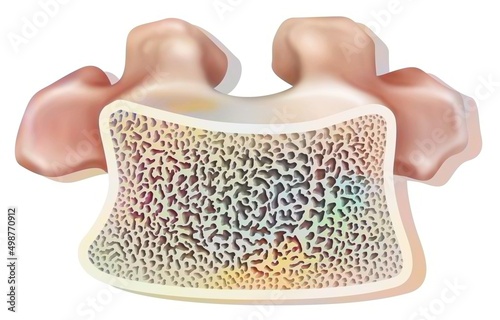 Fotografi Structure of a healthy dorsal vertebra with spongy and compact tissue