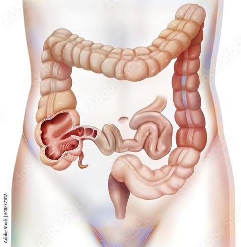 Obraz na plátně Digestive system: the colon or large intestine.