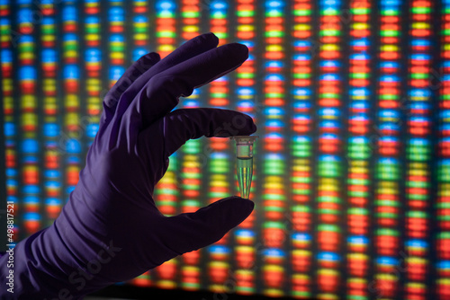 Hand holding a tube of DNA samples in front of a picture of a genome. photo