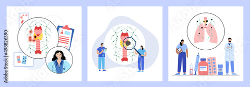 Thyroid cancer stages