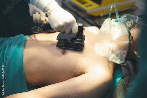 Doctor  using defibrillator to pump at chest of unconscious with low heart rate patient to save life while doing medical surgery inside of operating room. Emergency aid, CPR.