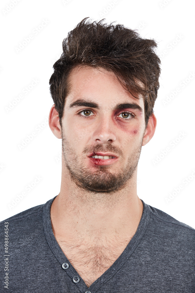 These wounds will heal. Studio portrait of a young man with scratches on his face against a white background. These wounds will heal. Studio portrait of a young man with scratches on his face against a white background.