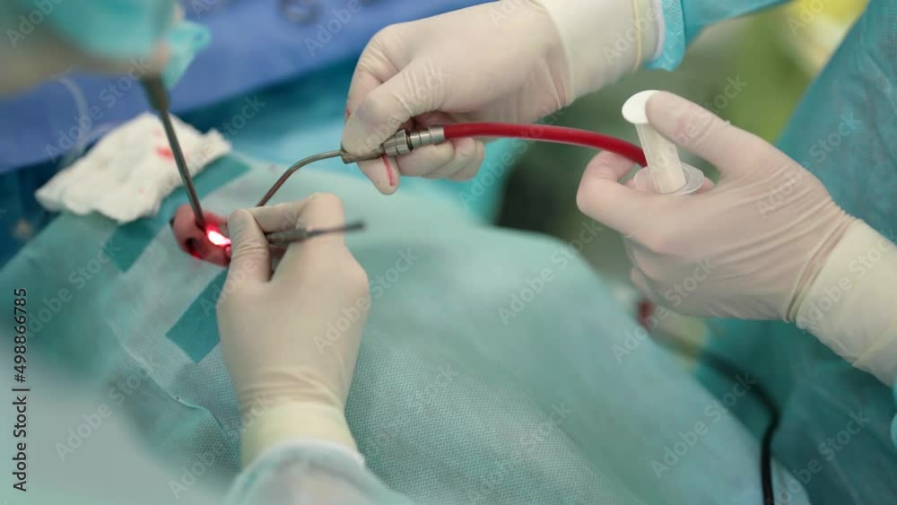 teams of skilled surgeons performing the operating procedure on the patient teams of skilled surgeons performing the operating procedure on the patient