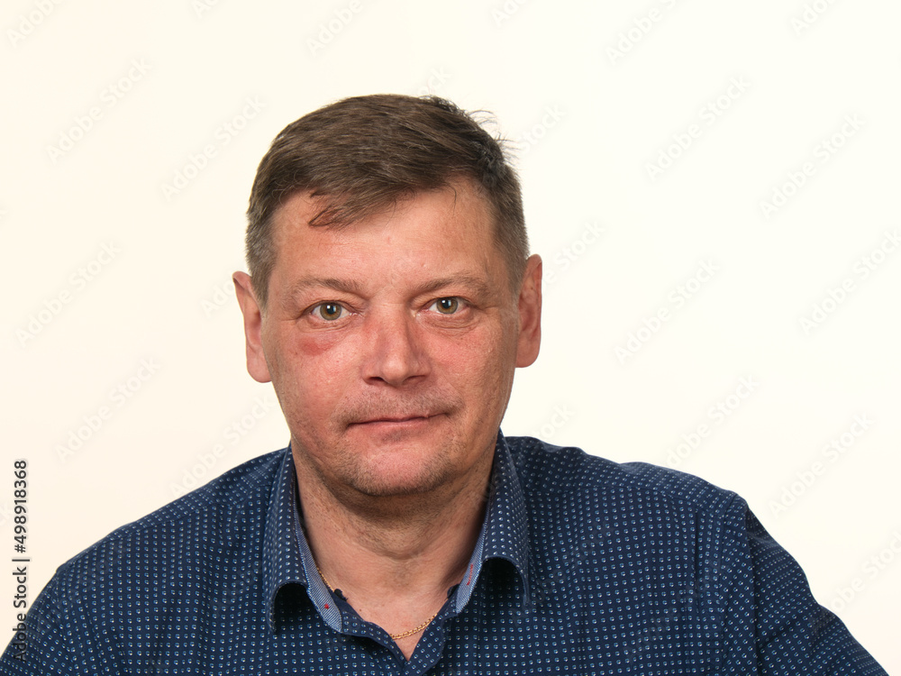 close-up portrait of a 50-year-old man with a swollen cheek and a black eye close-up portrait of a 50-year-old man with a swollen cheek and a black eye