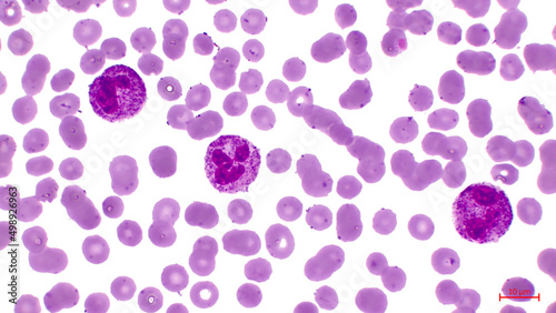 Light micrograph of human blood cells, showing numerous red cells (erythrocytes) and three neutrophils (white cells) with segmented nucleus. photo