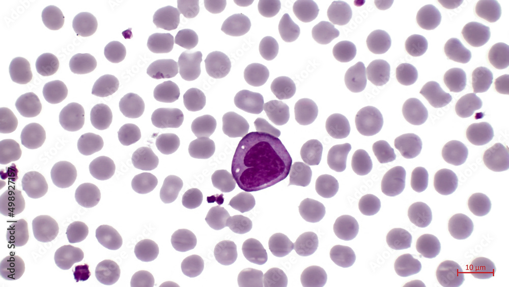 A smear of human blood under In the center among erythrocytes a large