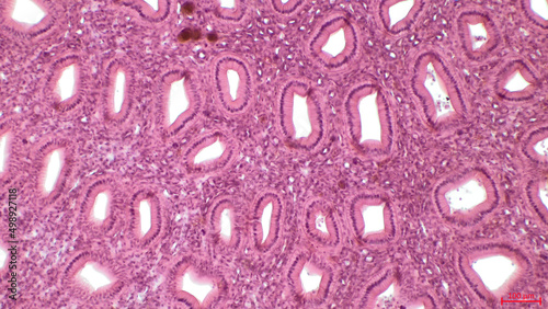 Simple columnar epithelium. Light micrograph of a renal medulla showing several collecting ducts lined by a simple columnar epithelium.  photo