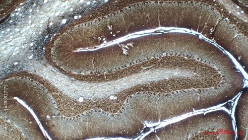 Canvas Print The cerebellar cortex is divided into three layers