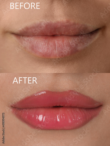 Fototapeta Collage with photos of young woman before and after permanent lip makeup, closeu