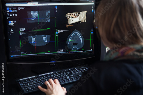 3D reconstruction from a scanner image of a patient's jaw. photo