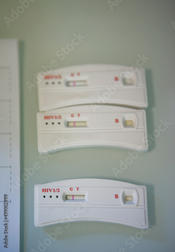 Rapid immunoassay for HIV. Immunodiagnotic photo