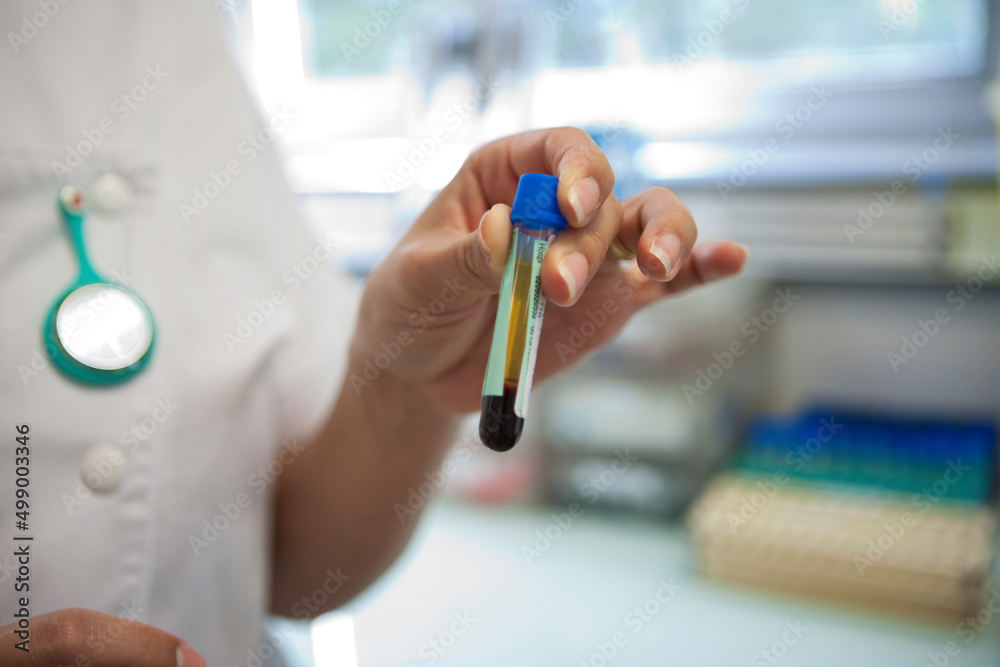 Tube of blood after centrifugation in the analysis laboratory. Tube of blood after centrifugation in the analysis laboratory.