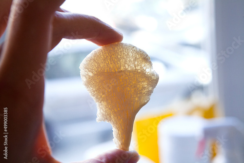 Quadro em tela Viro-inactivated bone graft prepared in a tissue and cell biobank