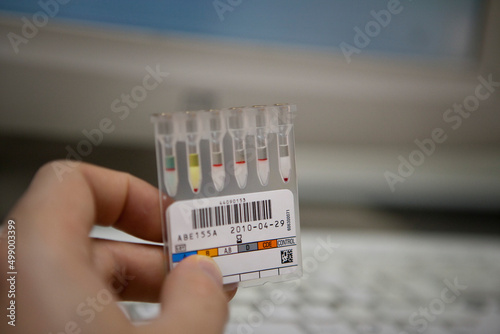 Quadro su tela Equipment used for establishing blood groups in a hospital analysis