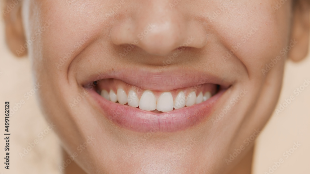 Extreme close-up of young African American woman's wide smile on beige background | Teeth health concept
