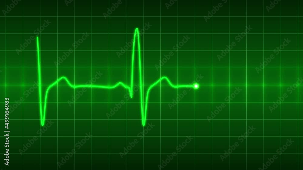 Healthy heartbeat animation. Pulse trace green line on dark green grid background. Seamlessly looping animation. Healthy heartbeat animation. Pulse trace green line on dark green grid background. Seamlessly looping animation.