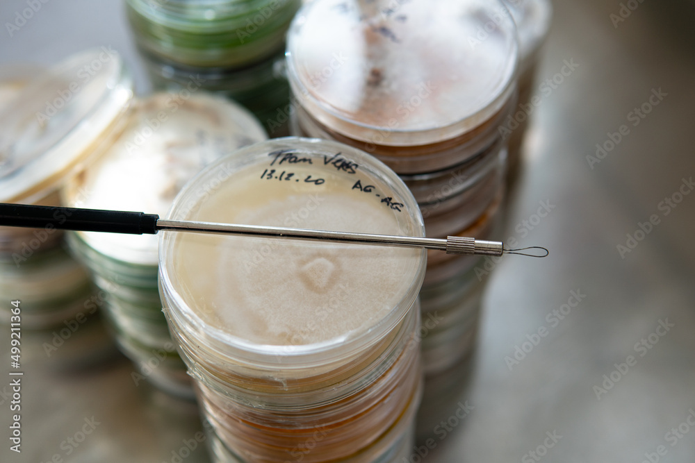 mycelium of exotic mushrooms in petri dishes. Selection and cultivation of mycelium. Mushroom cultivation around the world mycelium of exotic mushrooms in petri dishes. Selection and cultivation of mycelium. Mushroom cultivation around the world