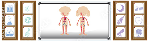Board showing human anatomy