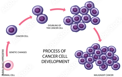Process of cancer cell development