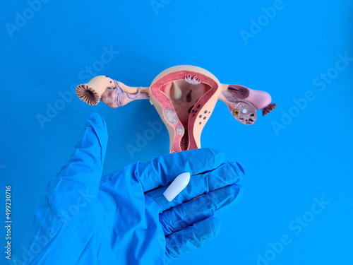 Medical vaginal suppository suppository tablet for venereal diseases. Bacterial vaginosis and vaginal infections