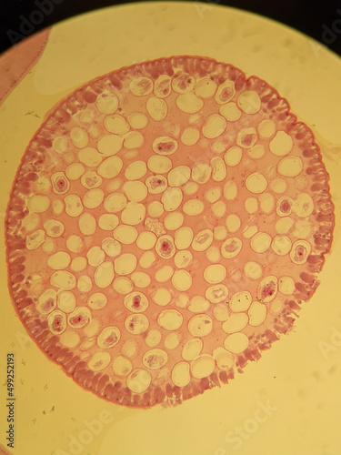 photo of faltworm tissue under the miccoscope photo