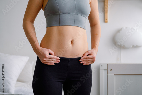 Close up of a belly with scar from c-section. Women’s health. A woman dressed up in sportswear demonstrating her imperfect body after a childbirth with nursery on the background.