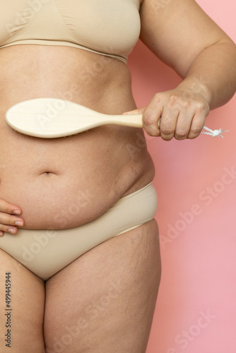 Cropped overweight woman belly with navel in pants with naked, excessive weight, Brush dry massage with natural stubble, rubbing. Rubbing belly properly, problems with cellulite and sagging skin