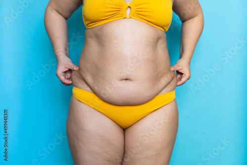 Pinch folds on woman sagging belly with hands closeup, big hips, obesity and cellulite. Naked overweight plus size girl on blue background in yellow underwear. Concept of dieting and lose weight.