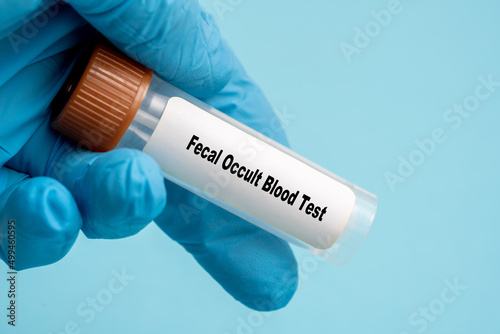 Fecal Occult Blood Test photo