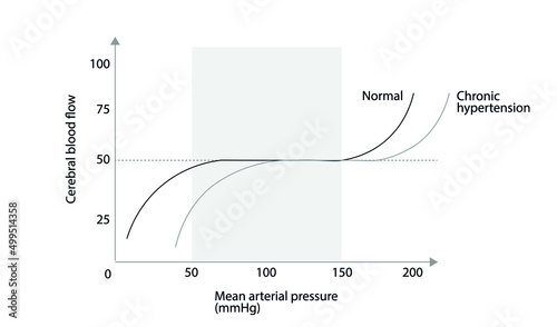 Cerebral autoregulation curve. Cerebral blood flow versus mean arterial pressure. Normal and chronic hypertension curve 