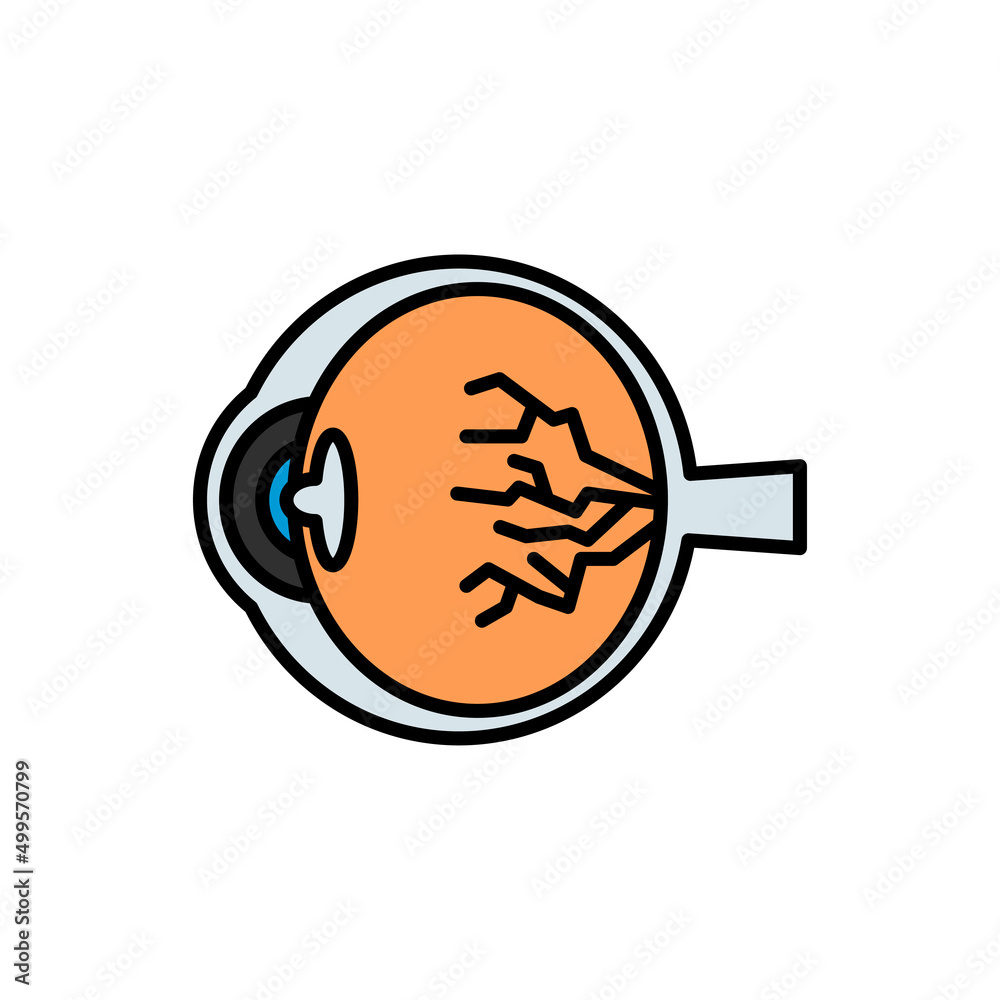 Diabetic eye line icon. linear style sign for mobile concept and web design. Diabetic retinopathy outline vector icon. Symbol, logo illustration. Vector graphics Diabetic eye line icon. linear style sign for mobile concept and web design. Diabetic retinopathy outline vector icon. Symbol, logo illustration. Vector graphics