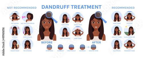 Dandruff on Female Head. Black Woman Treats Scalp from Dandruff. Set. Healthy Hair  and Happy Lady. Recommendations. Cartoon style. White background. Vector illustration for Medical and Beauty design.