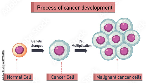 Process of cancer development infographic