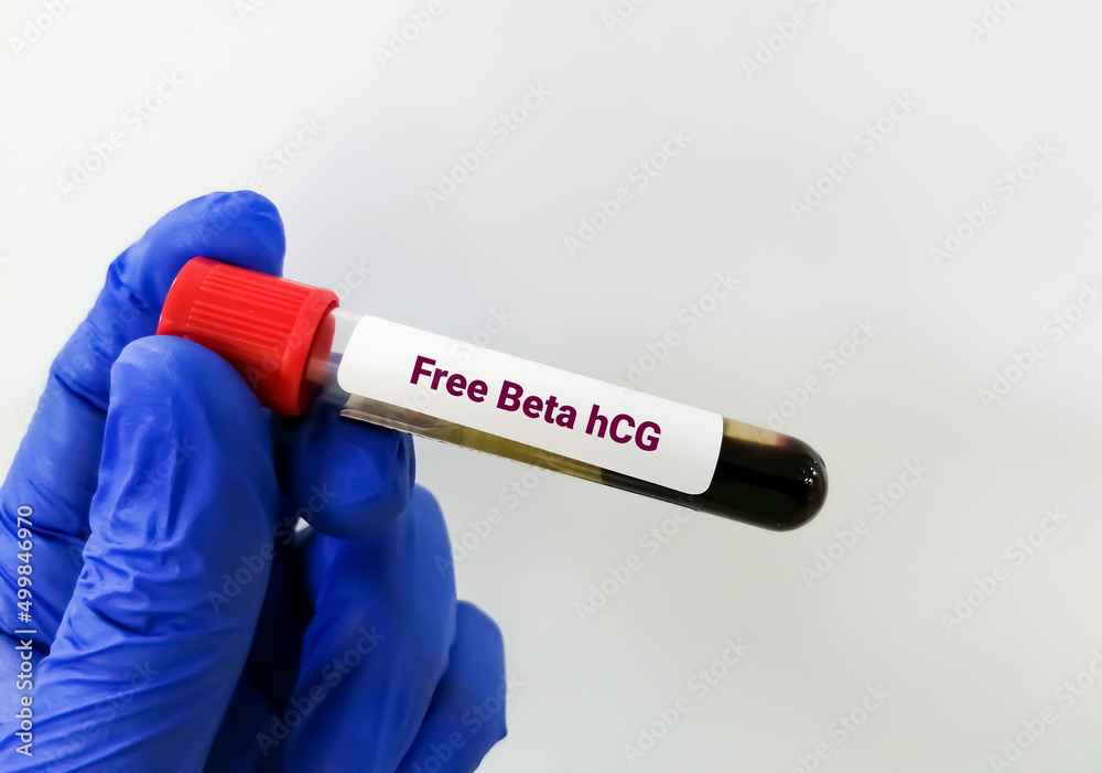 Fototapeta premium Blood sample for Free Beta hCG hormone test, health and medical concept
