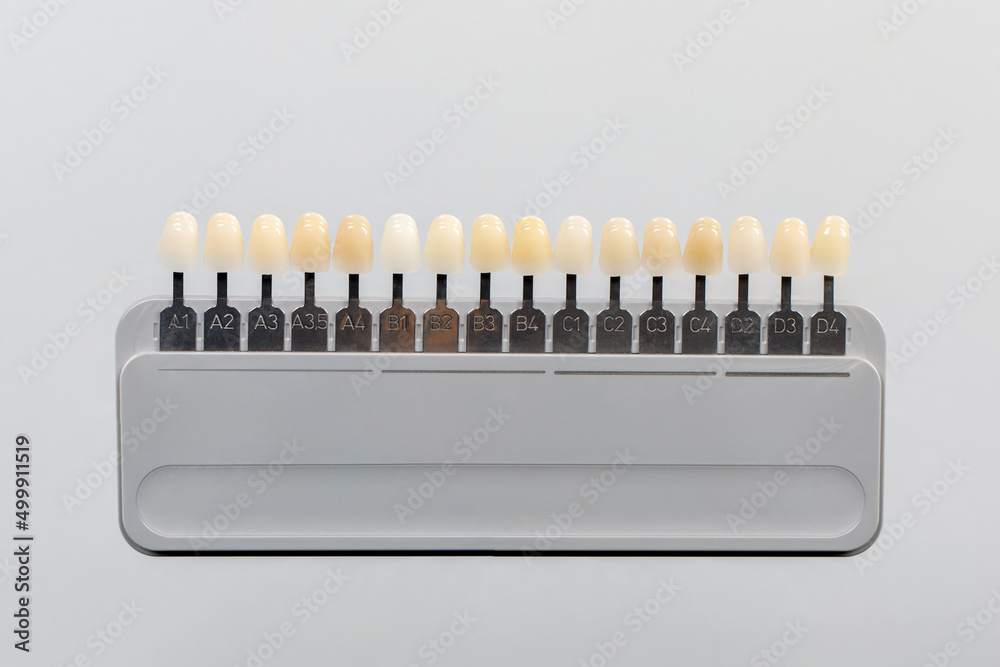 Palette of shades of teeth scale vita. A tool for teeth whitening isolate on a gray background. - obrazy, fototapety, plakaty 