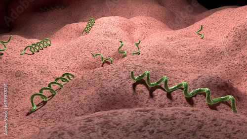 Syphilis infection, illustration photo