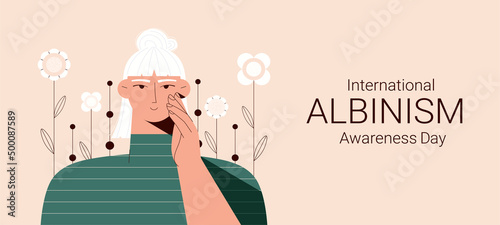 Portrait of albino woman. Vector illustration of woman with albinism taking care of her skin. International albinism awareness day. Albinism.Genetic rare disorder.Self care,body positive concept.