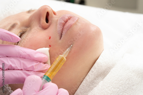 Cosmetologist makes prp-therapy blood plasma against wrinkles around the eyes and skin aging on the face of an adult woman Real procedure. The concept of cosmetology.